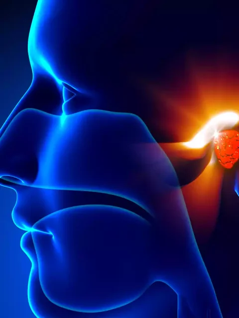 Understanding and Managing Adenoids cover