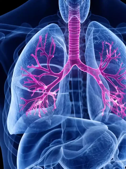 Understanding and Managing Bronchitis cover